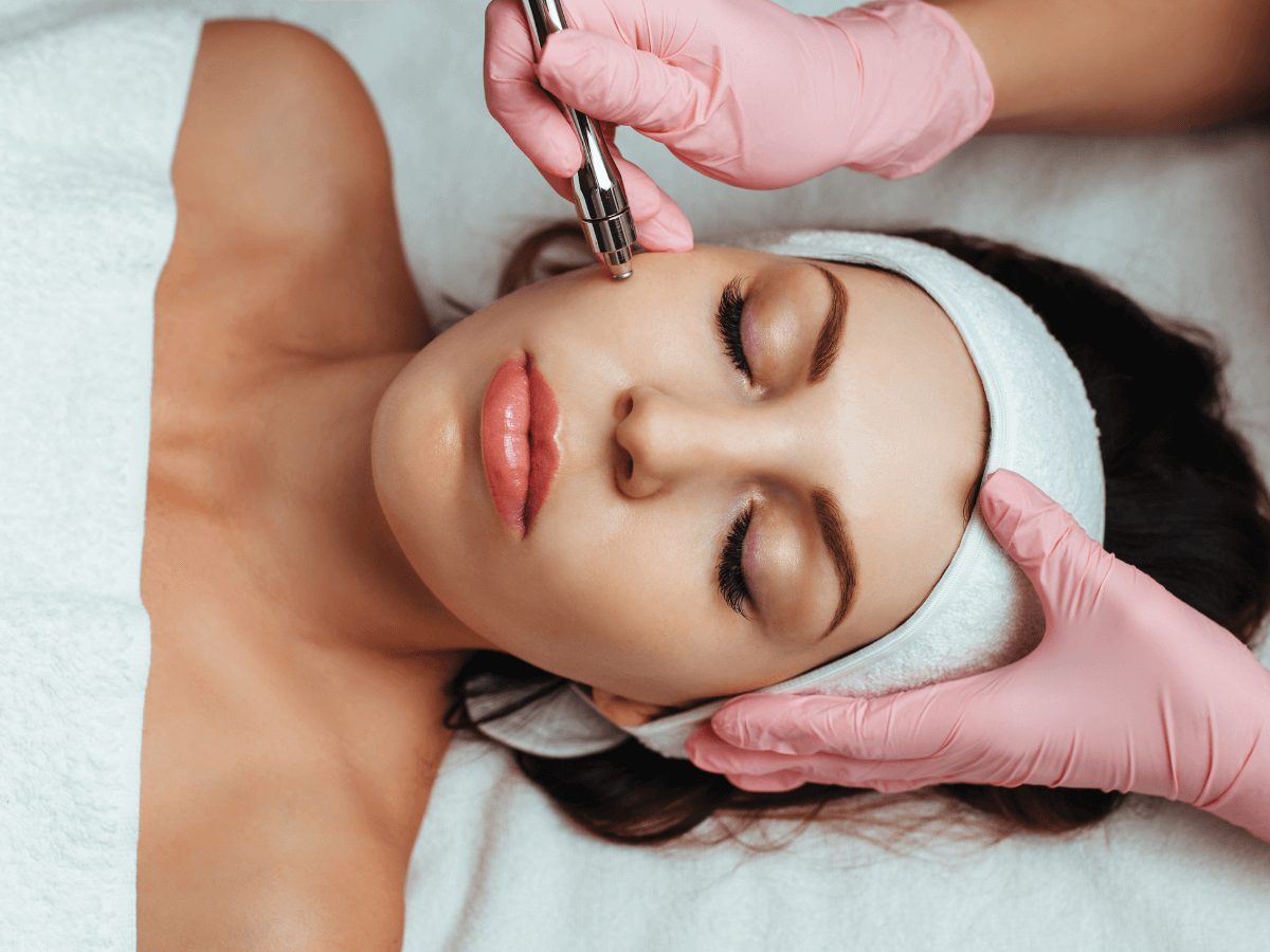 benefits of microdermabrasion