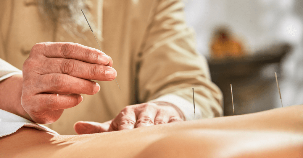 Acupuncture Chinese medicine for moms
